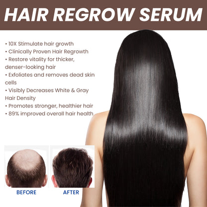 EELHOE Hair Growth Serum - Anti Hair Loss Treatment with Natural Botanicals | 30ml