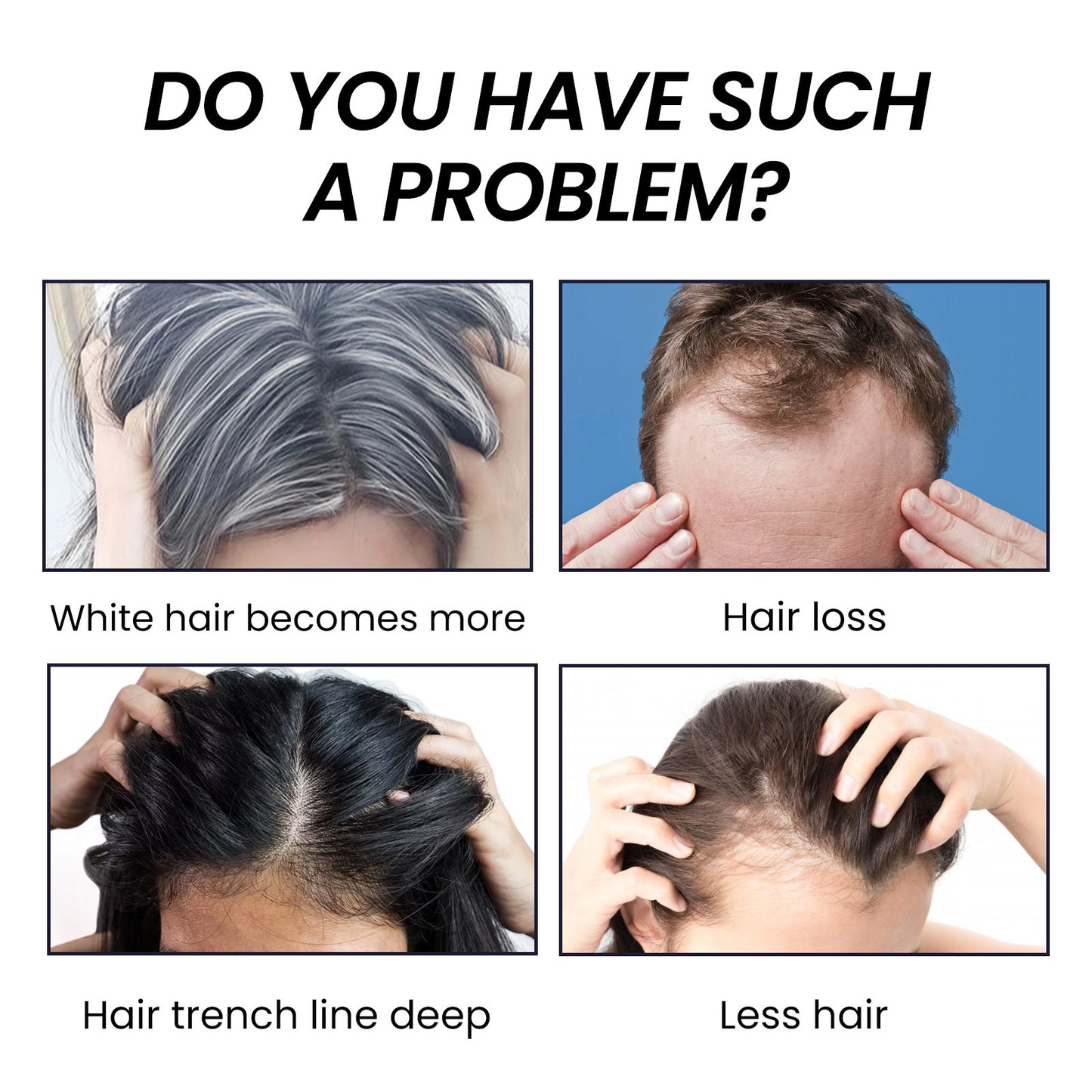 EELHOE Hair Growth Serum - Anti Hair Loss Treatment with Natural Botanicals | 30ml