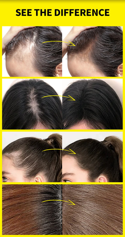 Sevich 10g Hairline Powder Hair Fiber Powder Capillary Filling Hair Shadow Waterproof Hairline Edge Control Makeup Concealer