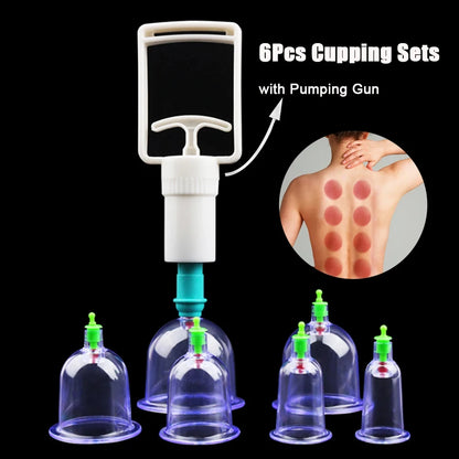 Vacuum Cupping Massage Kit w/ Pump Gun - 6 Suction Cups for Back, Body Therapy, Anti-Cellulite & Detox