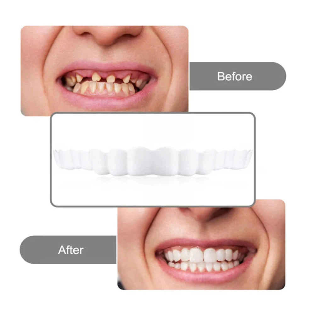 2 Pairs Regain Confident Smile Smile Whitening Teeth Snap Cap Denture Care Comfort Upper and Lower Jaw Denture for Men and Women
