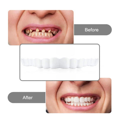 2 Pairs Regain Confident Smile Smile Whitening Teeth Snap Cap Denture Care Comfort Upper and Lower Jaw Denture for Men and Women