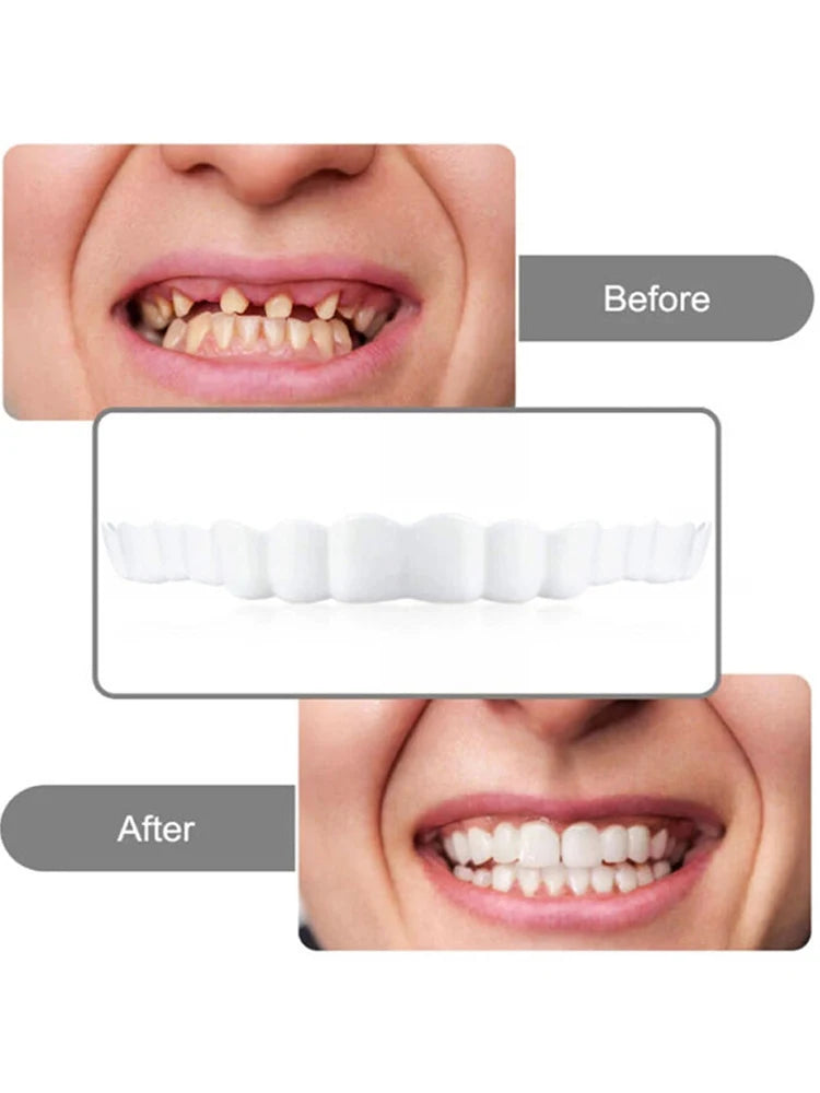 2 Pairs Regain Confident Smile Smile Whitening Teeth Snap Cap Denture Care Comfort Upper and Lower Jaw Denture for Men and Women