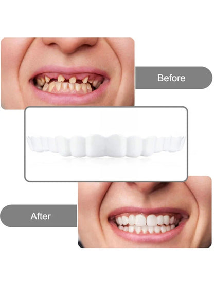 2 Pairs Regain Confident Smile Smile Whitening Teeth Snap Cap Denture Care Comfort Upper and Lower Jaw Denture for Men and Women