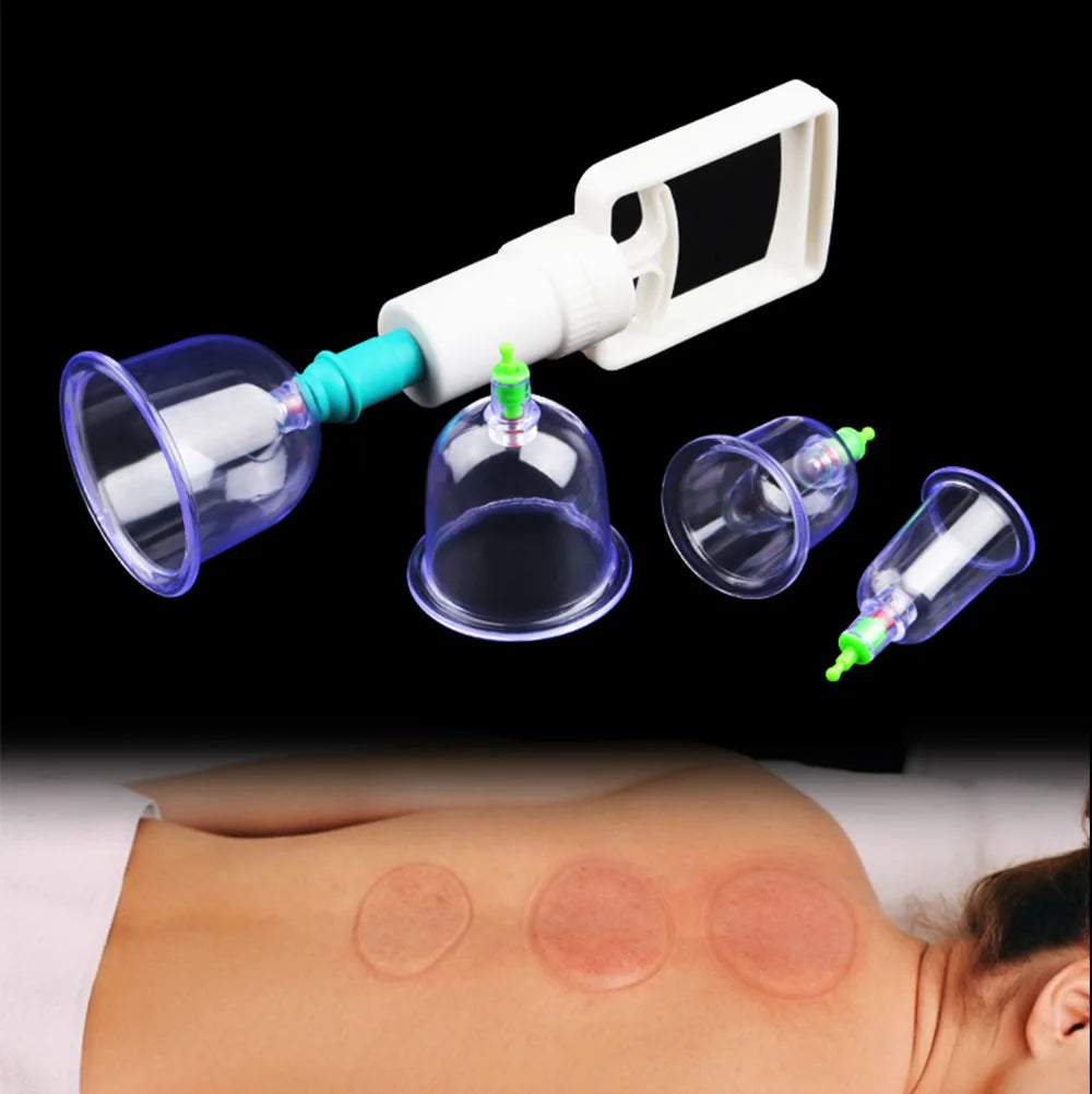 Vacuum Cupping Massage Kit w/ Pump Gun - 6 Suction Cups for Back, Body Therapy, Anti-Cellulite & Detox