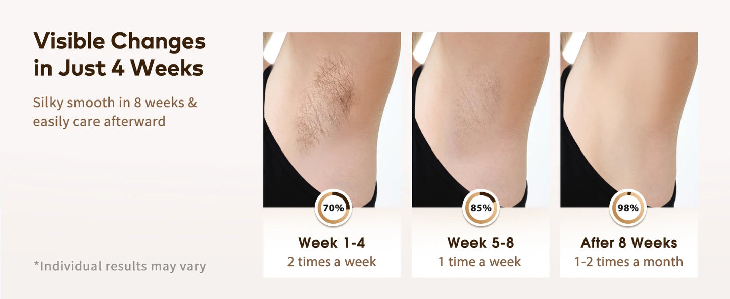 IPL Devices Hair Removal laser 9 Energy Levels 999900 Light Pulses Permanent Painless Laser Hair Removal for men women Whole Use