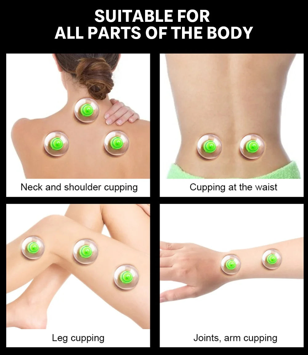 Vacuum Cupping Massage Kit w/ Pump Gun - 6 Suction Cups for Back, Body Therapy, Anti-Cellulite & Detox