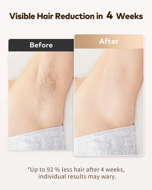 IPL Devices Hair Removal laser 9 Energy Levels 999900 Light Pulses Permanent Painless Laser Hair Removal for men women Whole Use