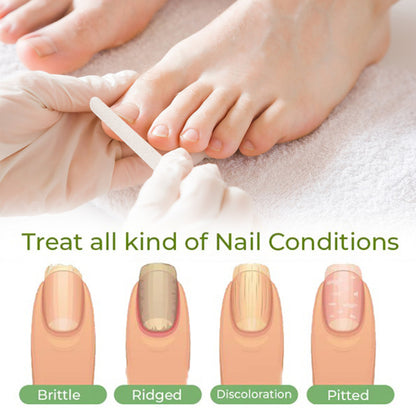 Repair Pen Hand And Foot Nail Repair Pen Cleaning