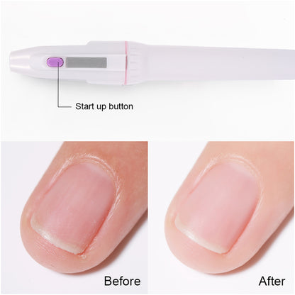 Electric Nail Drill Kit Electric Nail Files with 5 Pieces Changeable Drills for Exfoliating Grinding Polishing Nail Removing